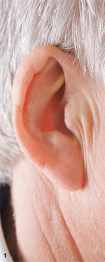 Wunderwerk Ohr: 24 Stunden am Tag laufen in den Ohren etwa 25.000 Hörzellen auf Hochtouren.