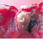 Durch Kirschessigfliege befallene Frucht.