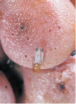 Fäulnis lockt Kirschessigfliegen an.