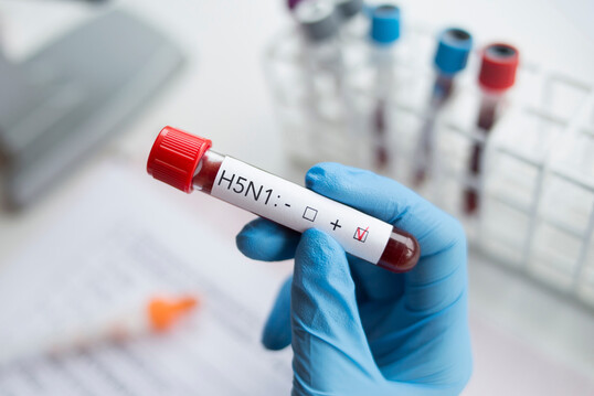 Im niederschsischen Kreis Friesland wurden Putenhhne positiv auf das AI-Virus getestet.