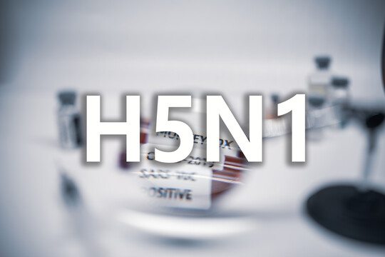 Aufgrund einer neuen Bundesverordnung werden in den USA landesweit Milchproben auf den HPAI-Virus-Subtyp H5N1 getestet.